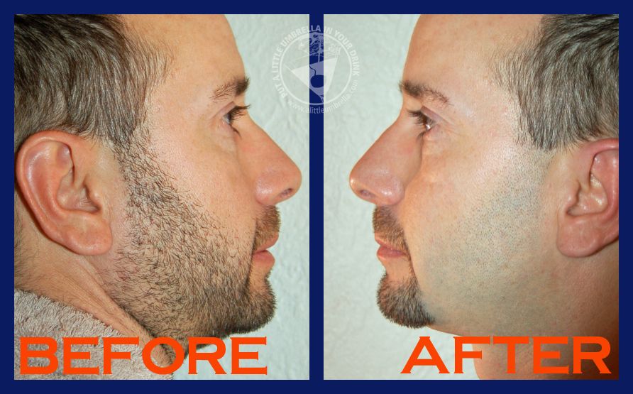 before after shaving Gillette, Flexball, razor, smooth, shave, #SmoothSummer, #shop
